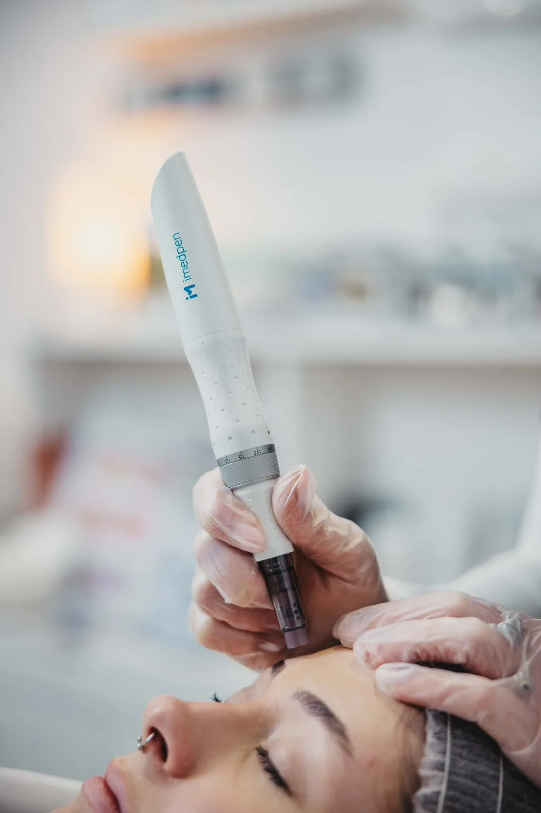Microneedling treatment at Gorgeous