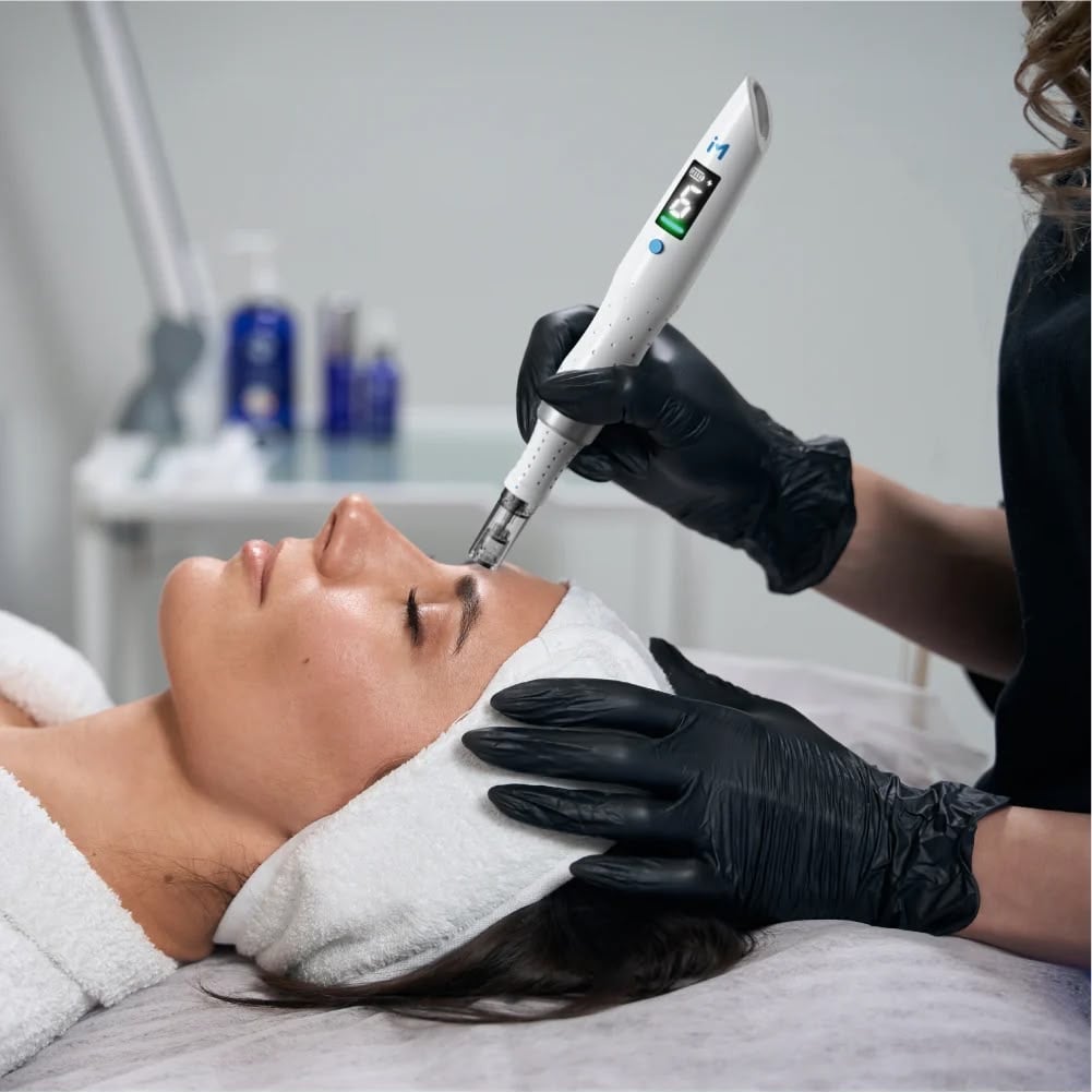 A microneedling treatment